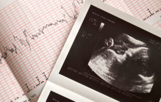 fetal monitoring ultrasound